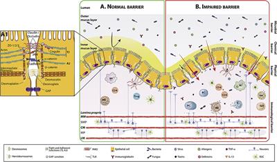 Present and Future Therapeutic Approaches to Barrier Dysfunction